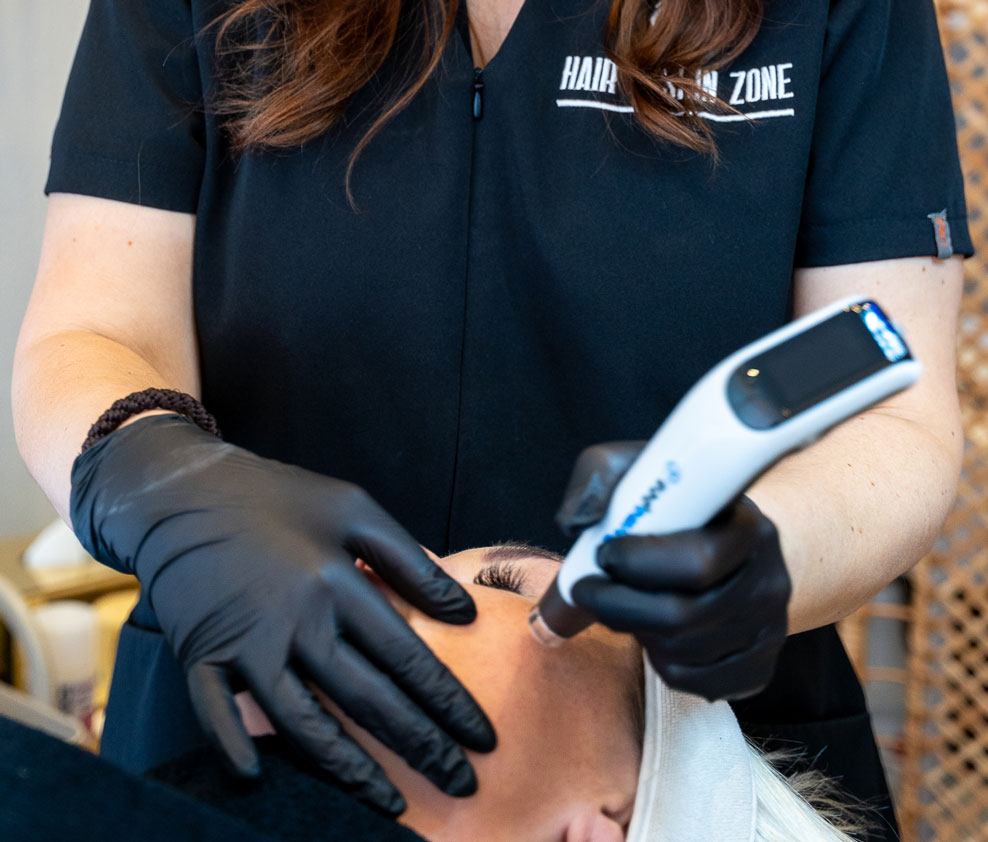 microneedling i randers