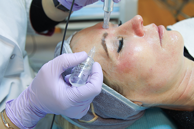 non invasiv meso terapi